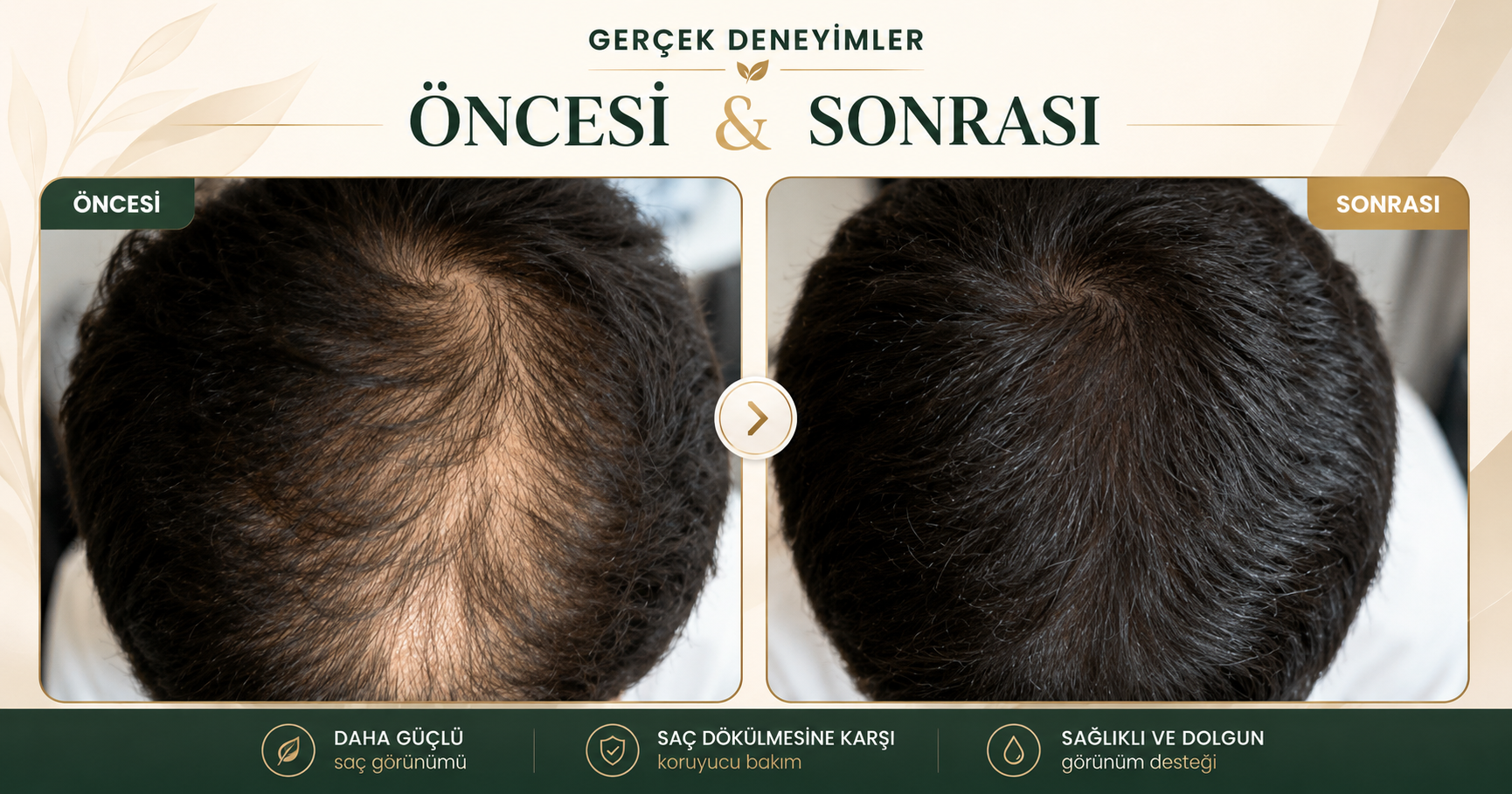 Folixia bakımı öncesi ve sonrası saç görünümü