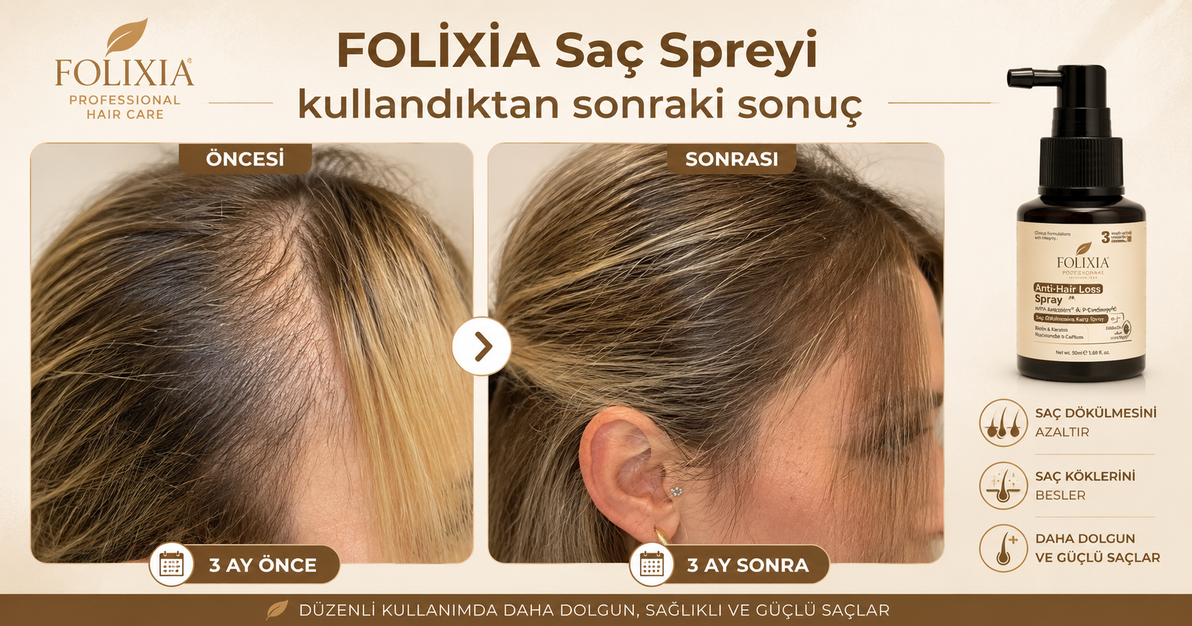 Folixia düzenli bakım deneyimi öncesi ve sonrası